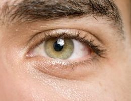 male-eyelid