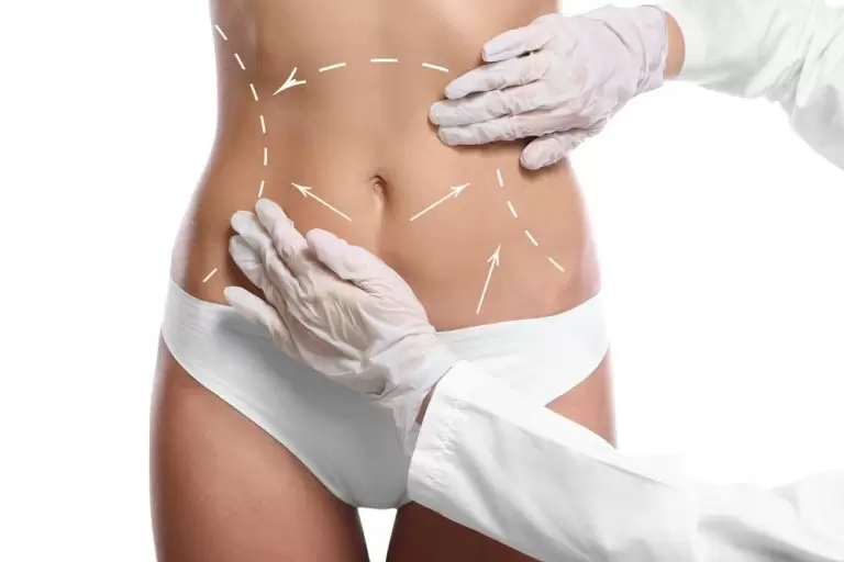 Baby Boomer Liposuction in New York and Jersey