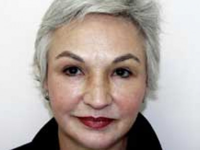 Facelift Before & After Patient #4377