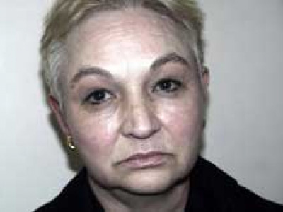 Facelift Before & After Patient #4377