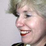 Facelift Before & After Patient #4360