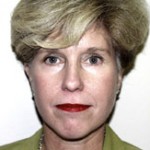 Facelift Before & After Patient #4360