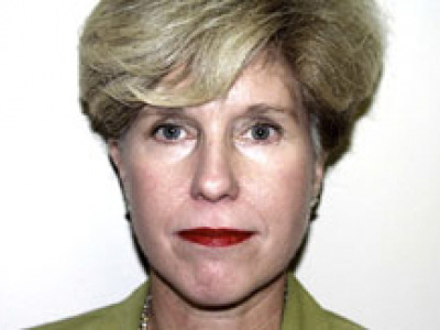 Facelift Before & After Patient #4360