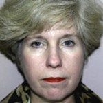 Facelift Before & After Patient #4360