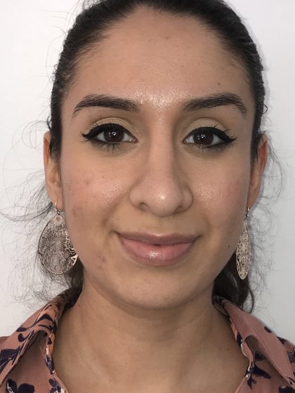 Rhinoplasty Before & After Patient #6394