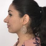 Rhinoplasty Before & After Patient #6394